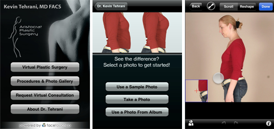 Virtual Plastic Surgery with iLipo
