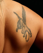 Aristocrat Plastic Surgery Laser Treatments