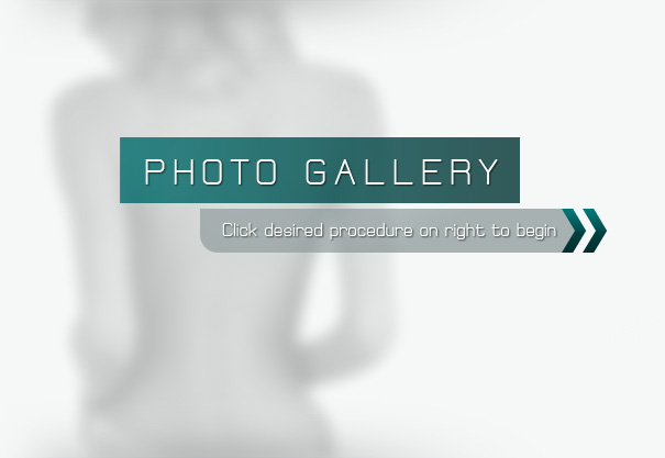 Plastic Surgery Before and After images