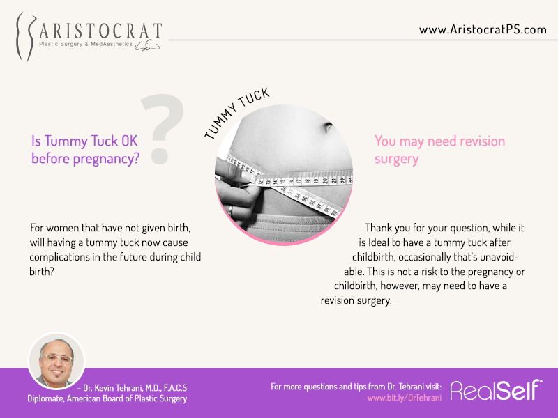 Q&A: Tummy tuck before pregnancy Aristocrat Plastic Surgery