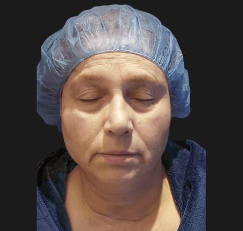 Case 36548, Performed By Dr. Tehrani – Before