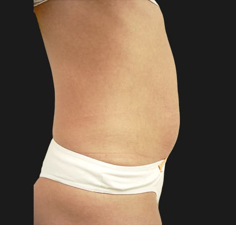 Case 5101, Performed By Dr. Tehrani – Before