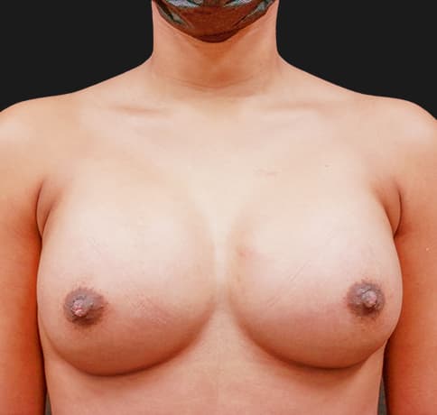 Case 56634, Performed By Dr. Tehrani – After