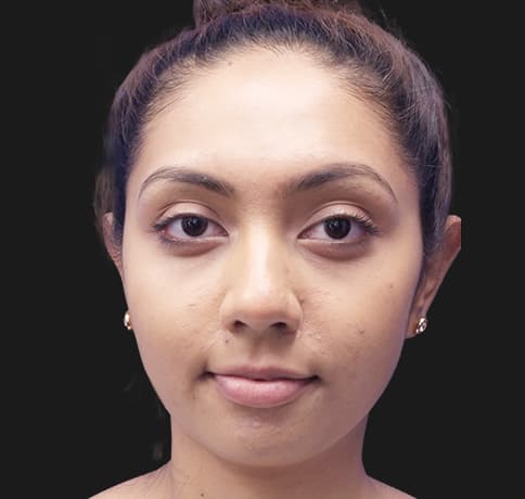 Case 32473, Performed By Dr. Tehrani – After