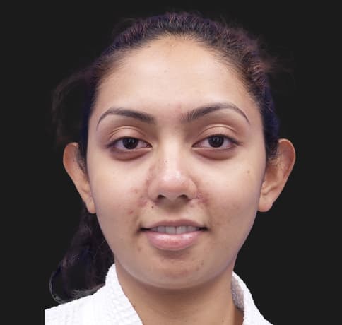 Case 32473, Performed By Dr. Tehrani – Before