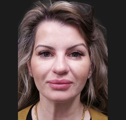 Case 47824, Performed By Dr. Tehrani – After