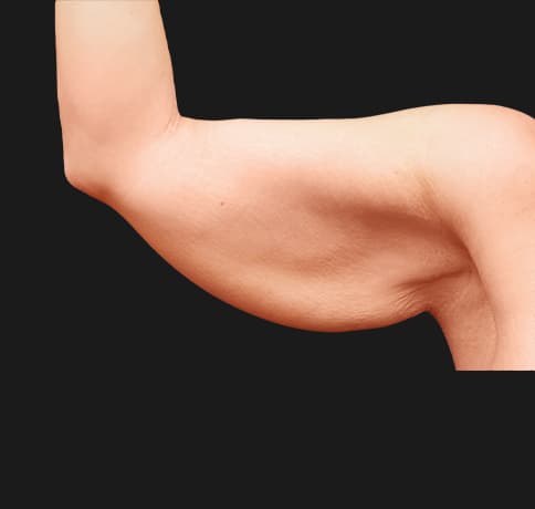 Case 36770, Performed By Dr. Tehrani – Before