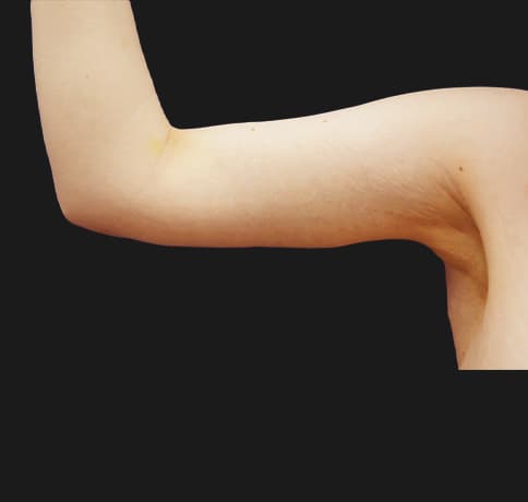 Case 24028, Performed By Dr. Tehrani – After
