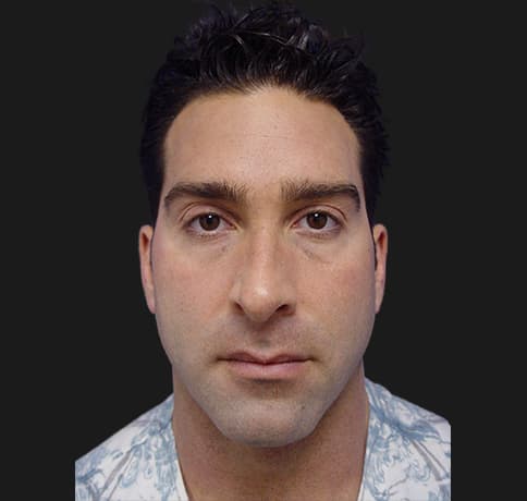Case 10157, Performed By Dr. Tehrani – After
