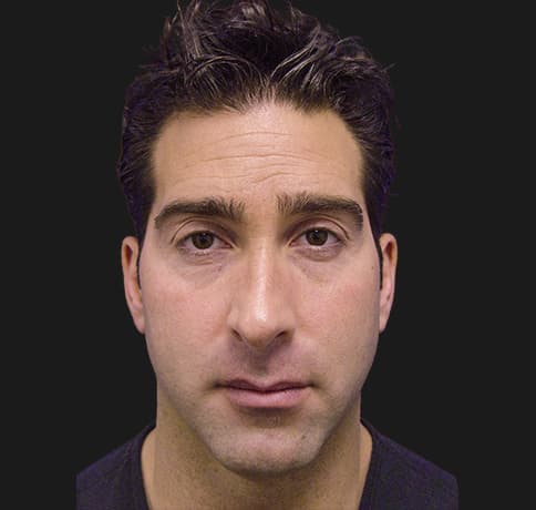 Case 10157, Performed By Dr. Tehrani – Before