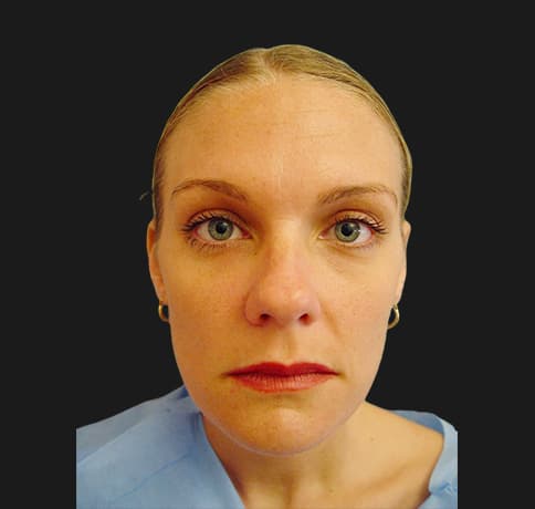 Case 7442, Performed By Dr. Tehrani – After
