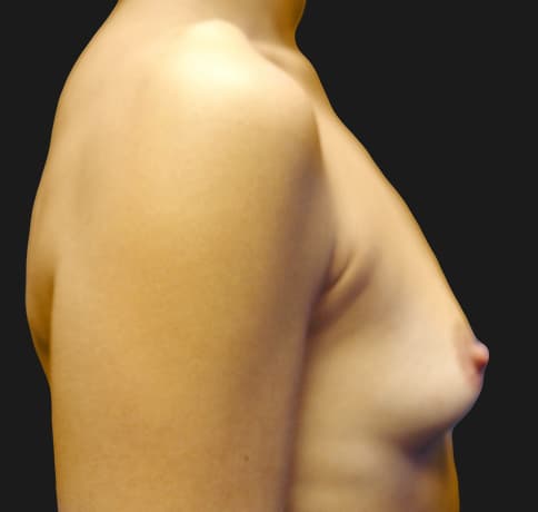 Case 12221, Performed By Dr. Tehrani – angle 5 Before