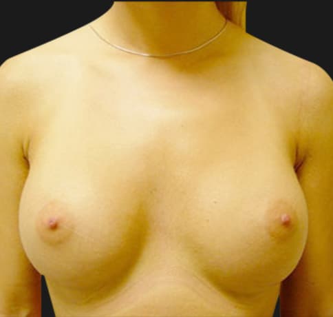 Case 7119, Performed By Dr. Tehrani – After