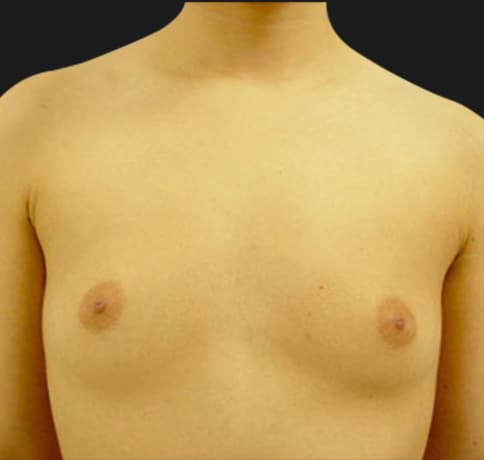 Case 7119, Performed By Dr. Tehrani – Before