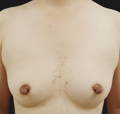 Case 7663, Performed By Dr. Tehrani – Before