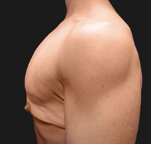 Case 9398, Performed By Dr. Tehrani – angle 4 Before