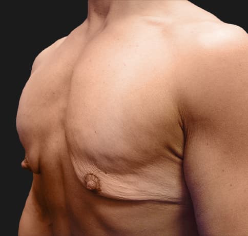 Case 9398, Performed By Dr. Tehrani – angle 3 Before