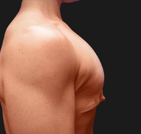 Case 9398, Performed By Dr. Tehrani – angle 5 Before