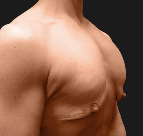 Case 9398, Performed By Dr. Tehrani – angle 2 Before
