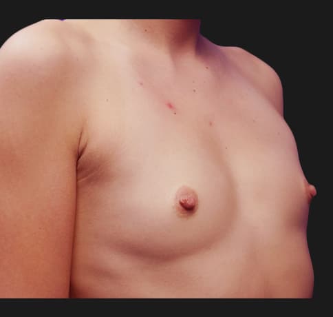 Case 20958, Performed By Dr. Tehrani – angle 2 Before