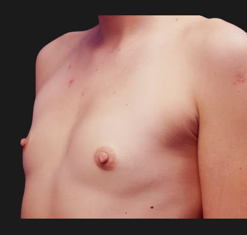 Case 20958, Performed By Dr. Tehrani – angle 3 Before