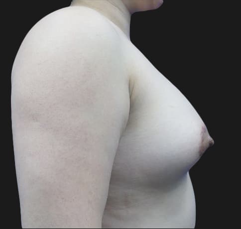 Case 34819, Performed By Dr. Tehrani – After