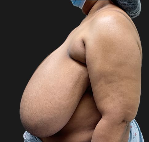 Case 57368, Performed By Dr. Tehrani – angle 3 Before