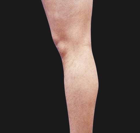 Case 41765, Performed By Dr. Tehrani – Before