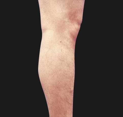 Case 41765, Performed By Dr. Tehrani – Before