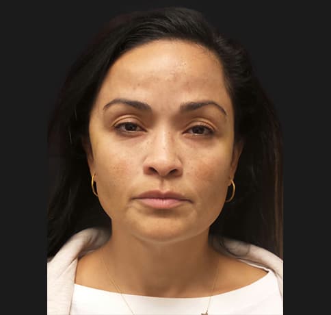 Case 52263, Performed By Dr. Tehrani – After