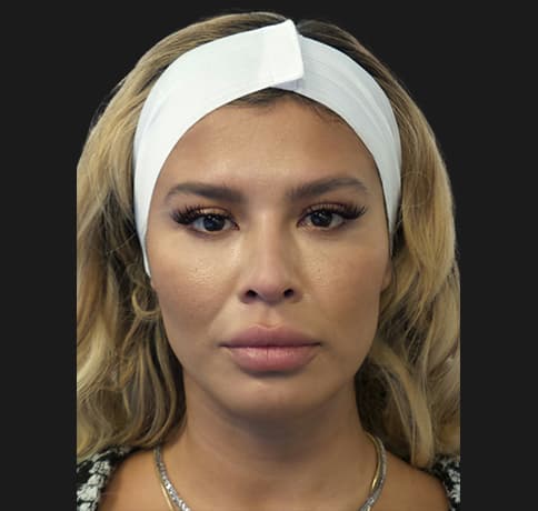 Case 53163, Performed By Dr. Tehrani – After