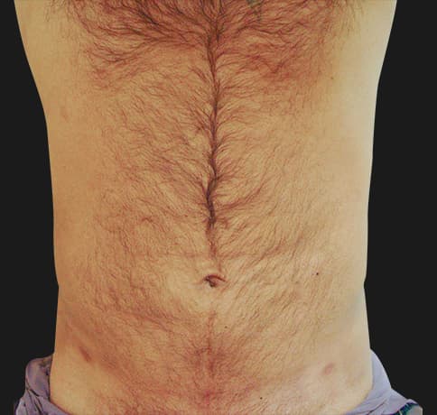 Case 8544, Performed By Dr. Tehrani – After