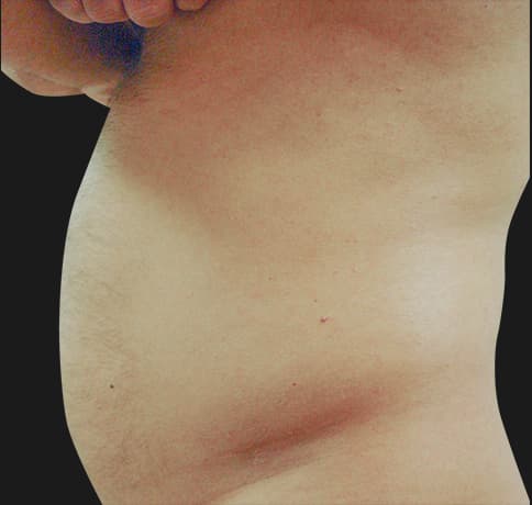 Case 8544, Performed By Dr. Tehrani – Before