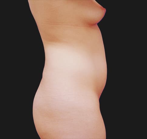 Case 8052, Performed By Dr. Tehrani – Before