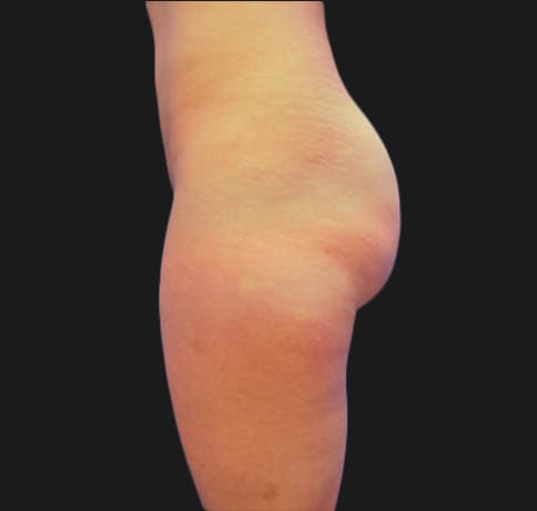 Case 6784, Performed By Dr. Tehrani – angle 3 Before
