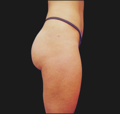 Case 6784, Performed By Dr. Tehrani – After