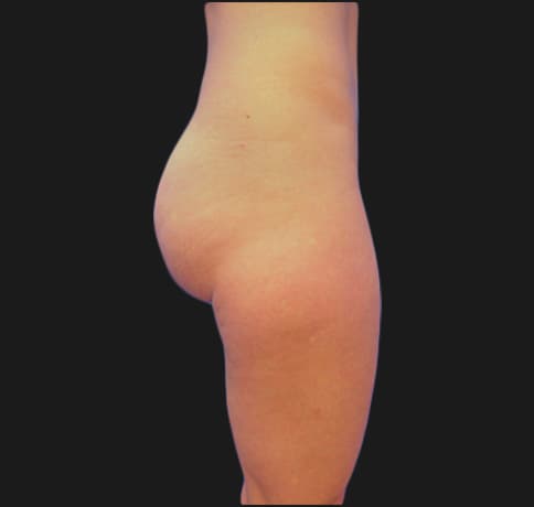 Case 6784, Performed By Dr. Tehrani – Before