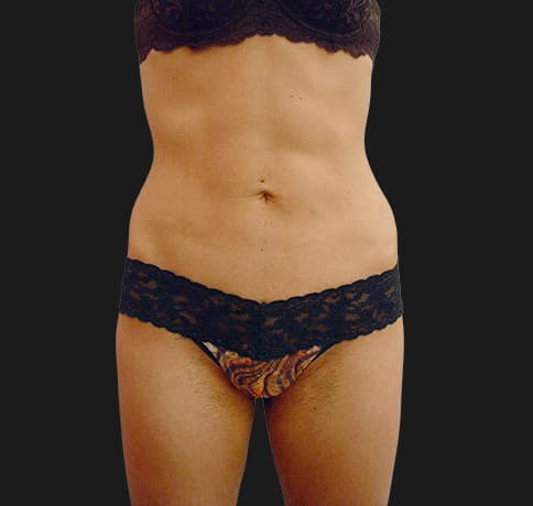 Case 8800, Performed By Dr. Tehrani – After