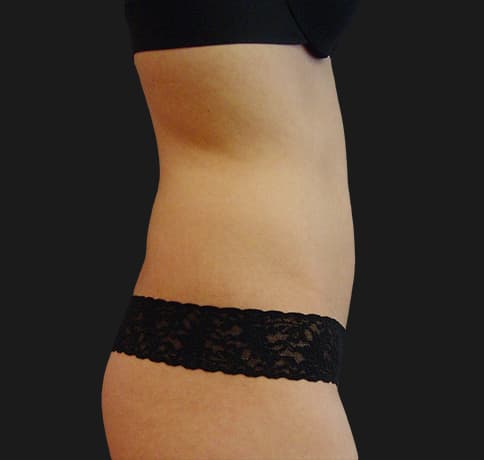 Case 8800, Performed By Dr. Tehrani – Before