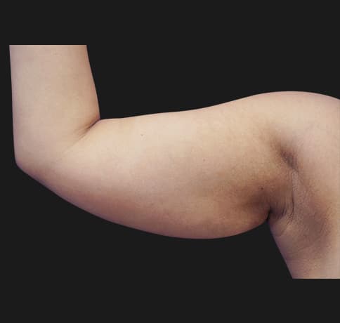 Case 28730, Performed By Dr. Tehrani – Before