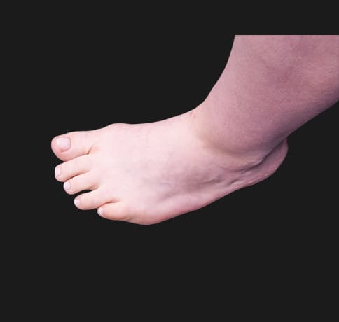 Case 42619, Performed By Dr. Tehrani – angle 2 After