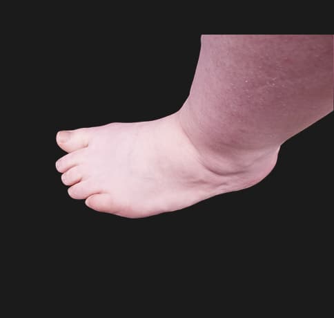Case 42619, Performed By Dr. Tehrani – angle 2 Before