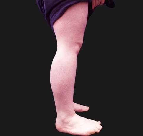 Case 42619, Performed By Dr. Tehrani – angle 3 Before