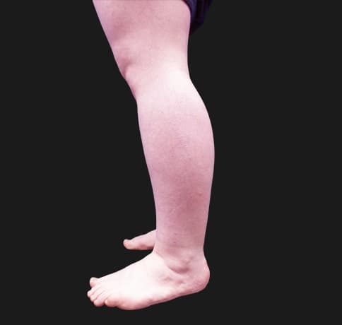 Case 42619, Performed By Dr. Tehrani – angle 4 After
