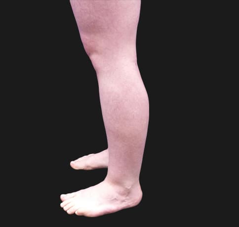 Case 42619, Performed By Dr. Tehrani – angle 4 Before