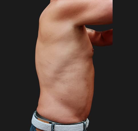 Case 57970, Performed By Dr. Tehrani – After