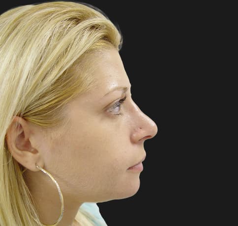 Case 7119 , Performed By Dr. Tehrani – After