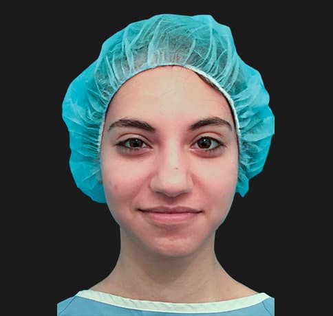 Case 34106 , Performed By Dr. Tehrani – angle 3 Before