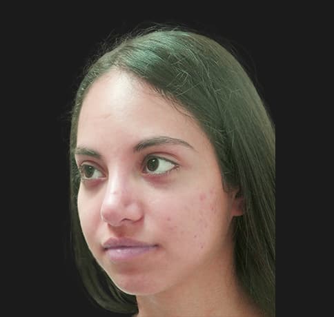 Case 34106 , Performed By Dr. Tehrani – angle 4 After