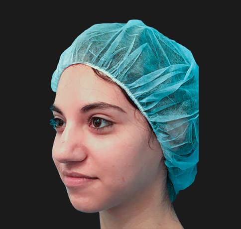 Case 34106 , Performed By Dr. Tehrani – angle 4 Before